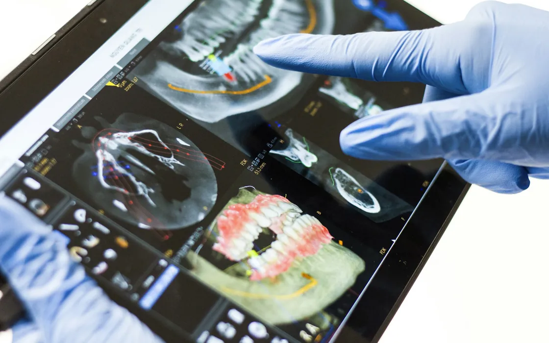 A clinician pointing out details on a dental scan displayed on a tablet