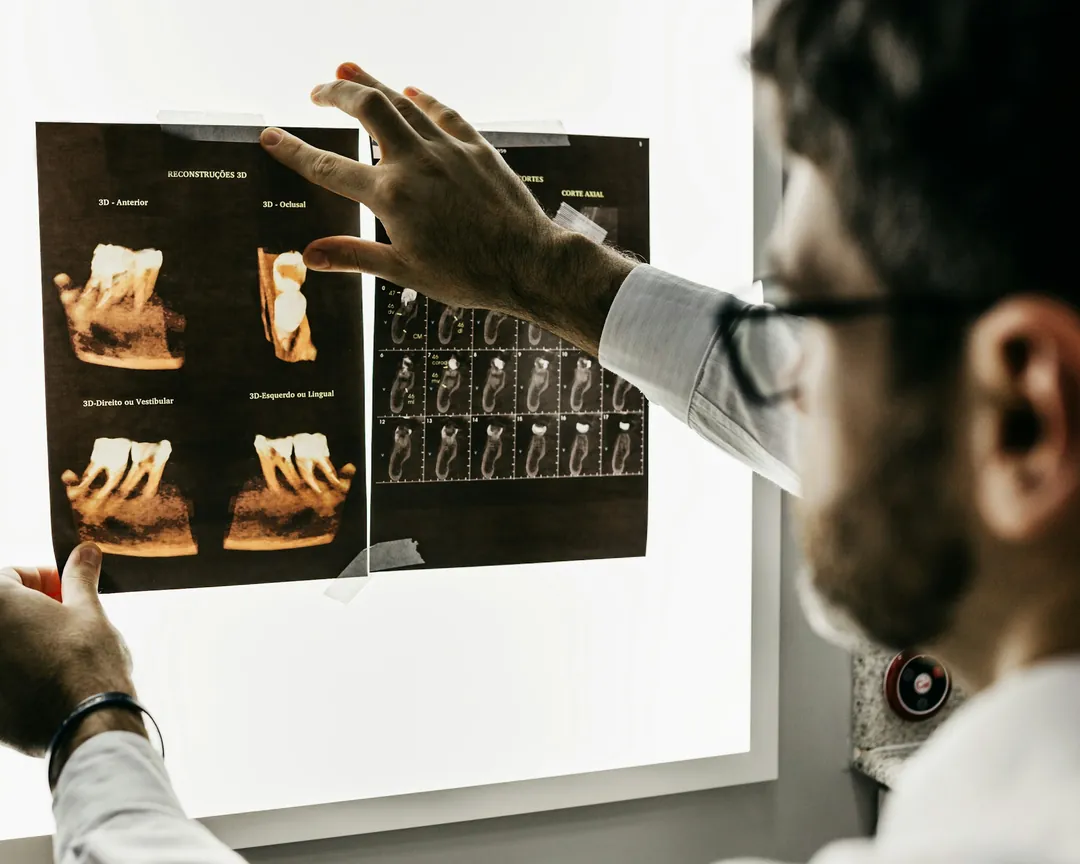 A dentist examining dental X-ray scans on a light box