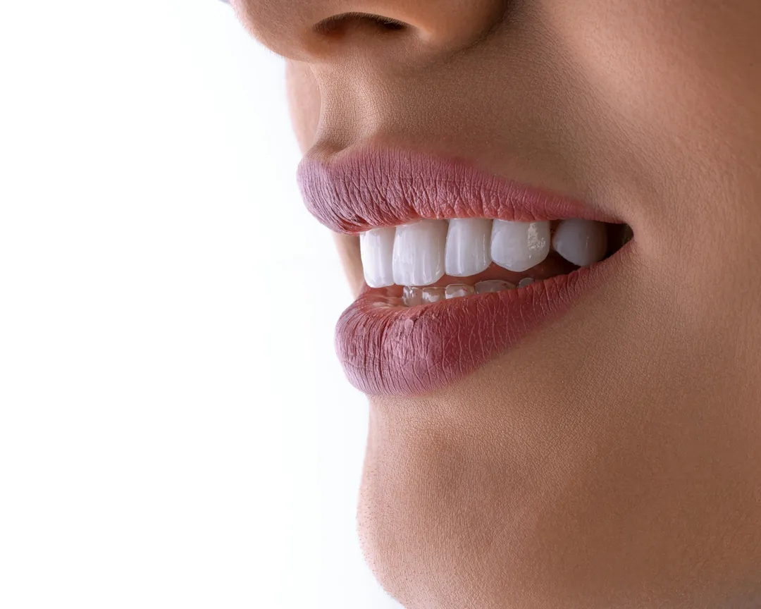 Close-up of a bright white smile